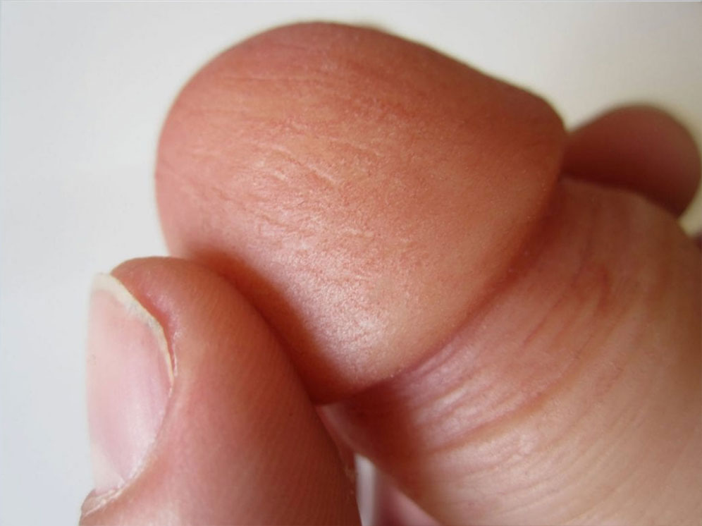 Tip of a junior EZP packer