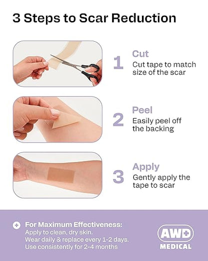 Silicone Scar Tape Roll - Surgery Healing