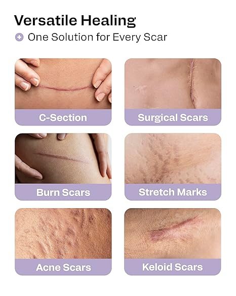 Silicone Scar Tape Roll - Surgery Healing